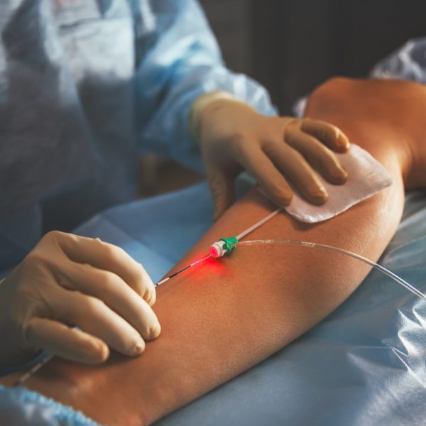 doctor t in the operating room for surgical venous vascular surgery clinic